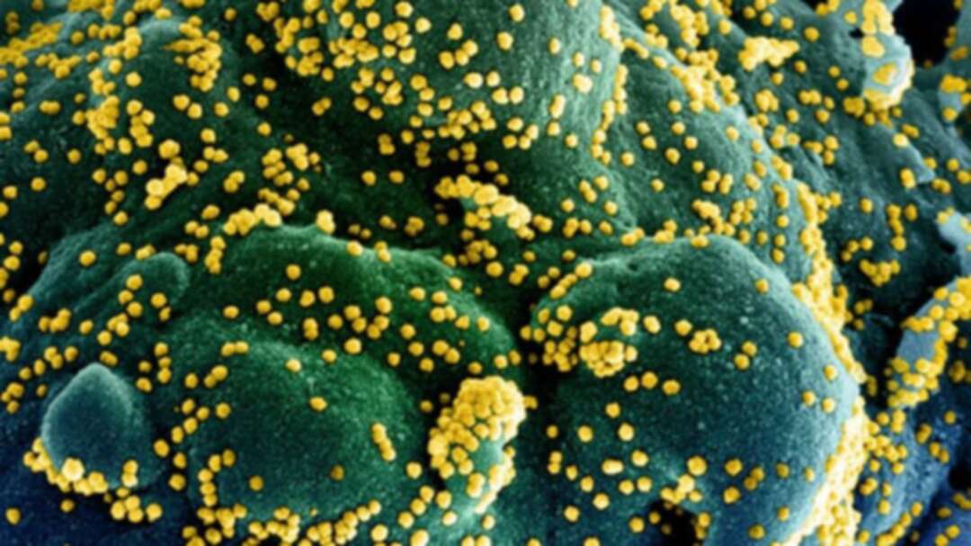 Coronavirus: Could COVID-19 be seasonal?