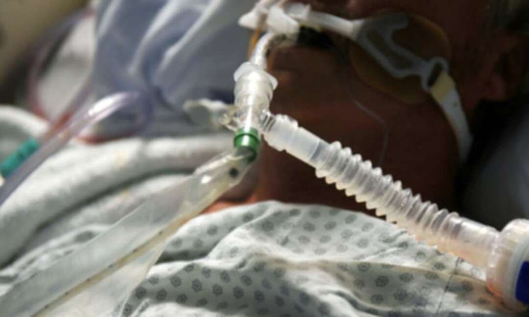 A third of Covid patients put on ventilator report PTSD symptoms