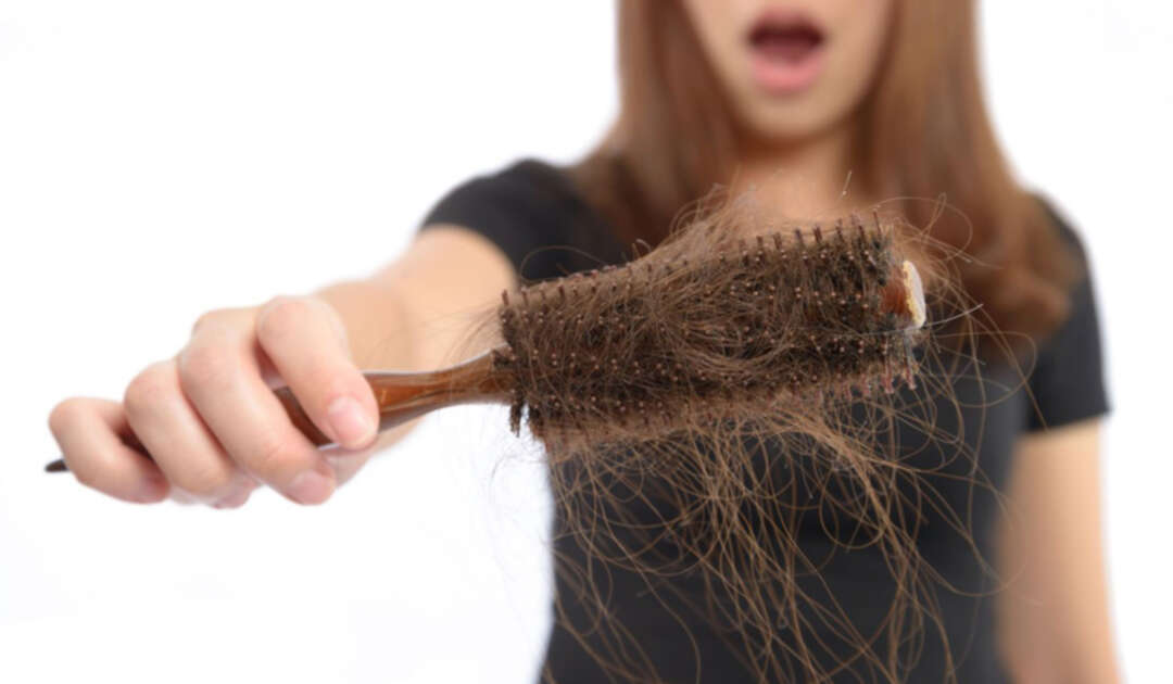 دراسة: المتعافون من كورونا معرّضون للإصابة بتساقط الشعر