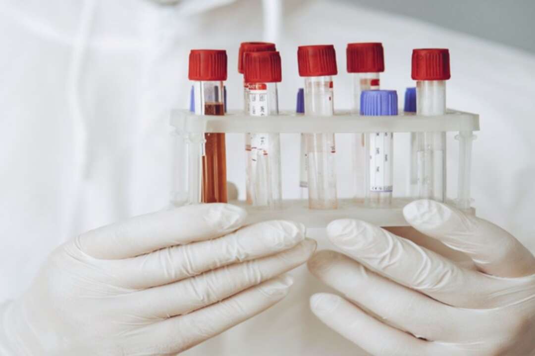 UK begins world’s greatest trial of blood test to detect over 50 types of cancer
