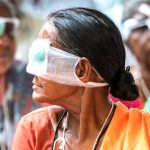 جراحة العيون في الهند