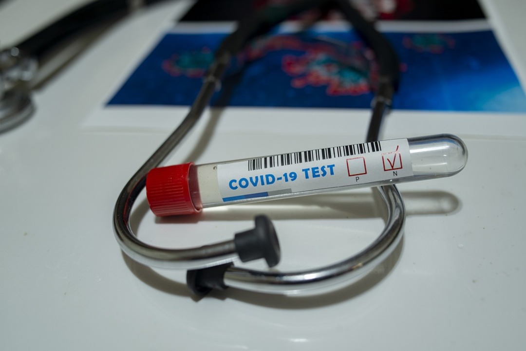 UAE announces that people who have come in direct contact with COVID-19 cases must undergo a PCR test on the first and seventh day from when the patient started showing symptoms (File photo: Pixabay)