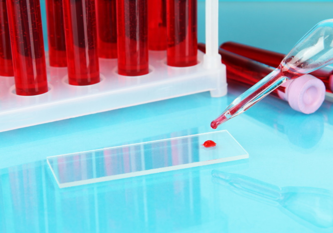 تجارب سريرية قد تُحدث ثورة بعمليات نقل الدم