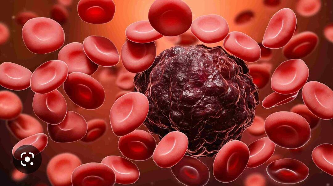 نجاح أول علاج لسرطان الدم 