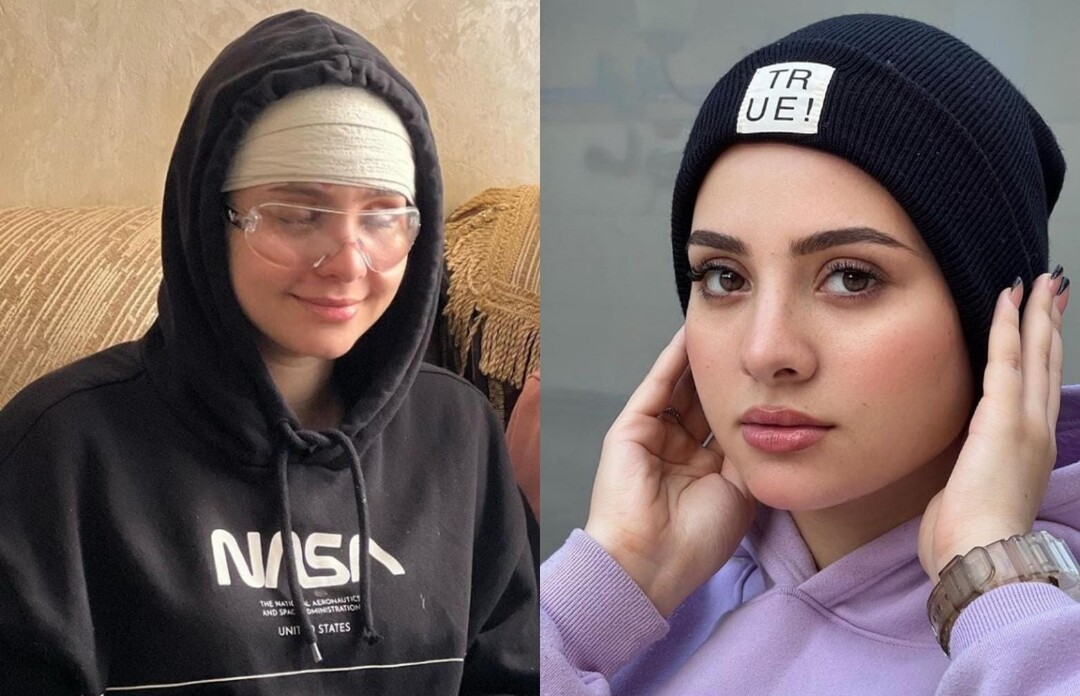 البلوغر المصرية سارة محمد تفقد بصرها بعد اعتداء مسلح