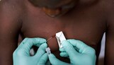 الصحة العالمية: لا حاجة لحملات تطعيم جماعية من 