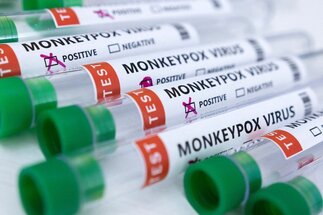 Patient with new strain of monkeypox hospitalized in U.K.