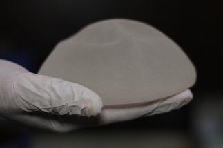 FDA: Breast implants linked to rare forms of cancer