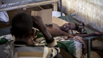 Cholera outbreak in Haiti hits children hardest