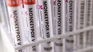 Study: Monkeypox pathogen has mutated surprisingly strongly